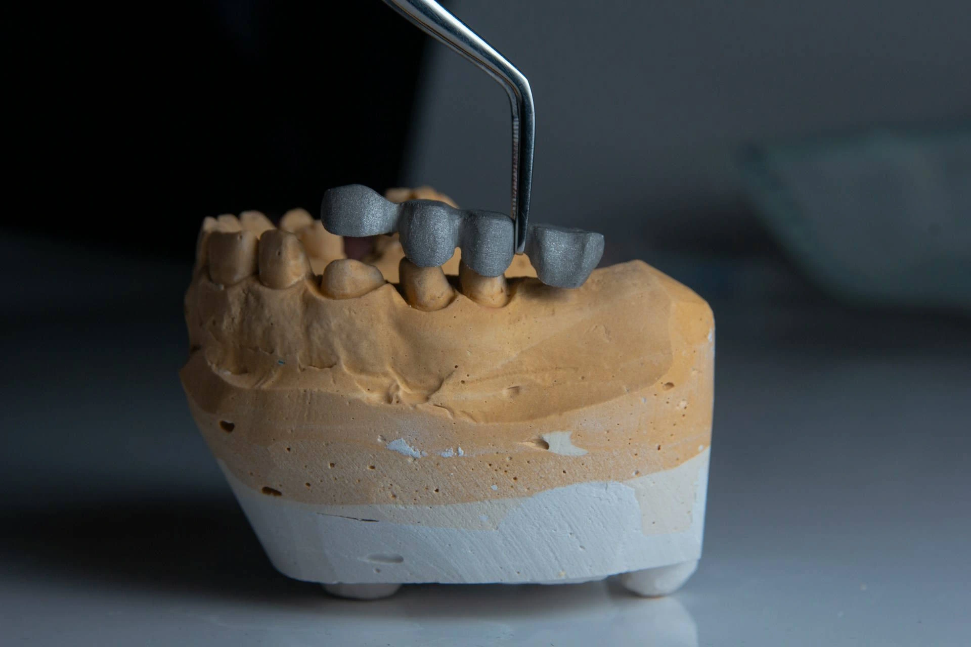 Dental_Bridge-Image_By-Ozkan_Guner-On_Unsplash Dental_Bridge-Image_By-Ozkan_Guner-On_Unsplash