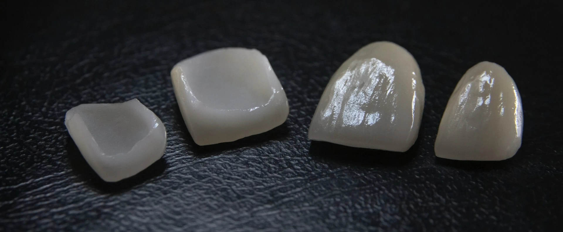 Porcelain_Veneers-PhotoBy-Ozkan_Guner-On_Unsplash Porcelain_Veneers-PhotoBy-Ozkan_Guner-On_Unsplash